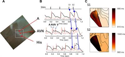 Conduction delays across the specialized conduction system of the heart: Revisiting atrioventricular node (AVN) and Purkinje-ventricular junction (PVJ) delays